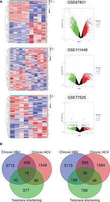 Establishment and validation of exhausted CD8+ T cell feature as a prognostic model of HCC